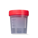 AMPri Urinsammelbehälter Schnappdeckel 100 ml